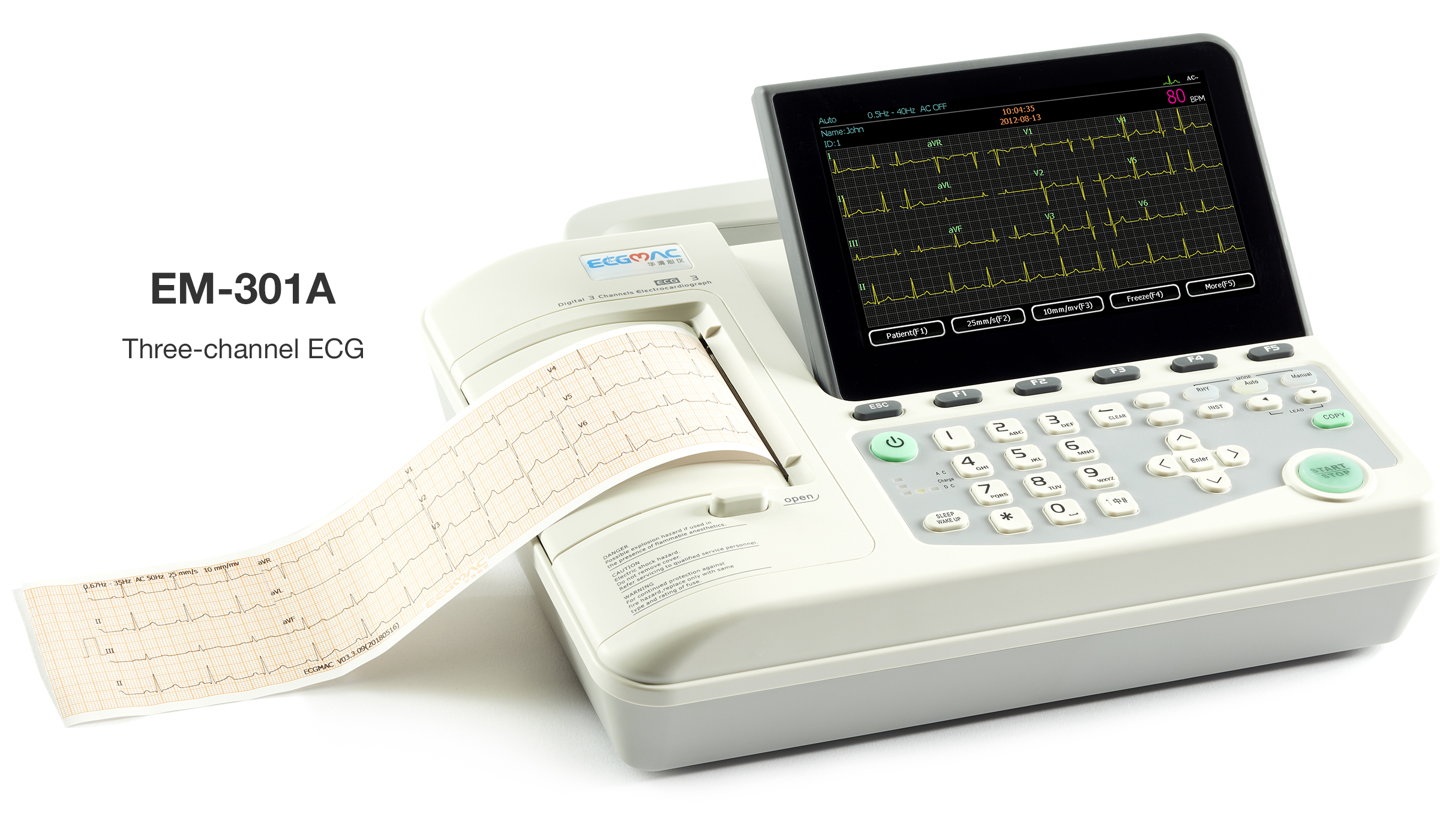 EKG